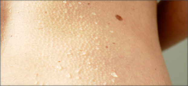 Woman's skin - mole checks at private practice Prof. Dr. Okamoto, Vienna